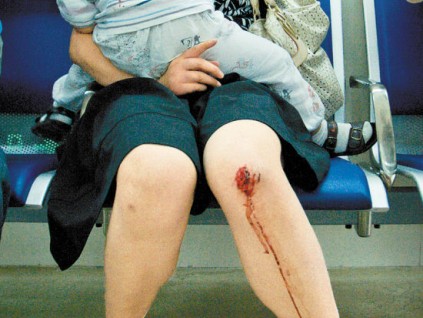 廣州崗頂?shù)罔F電梯發(fā)生意外 2人受傷